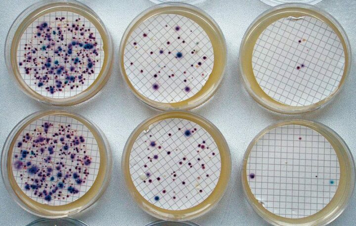 04: Escherichia coli